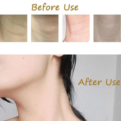 Face Neck Lifting Tape